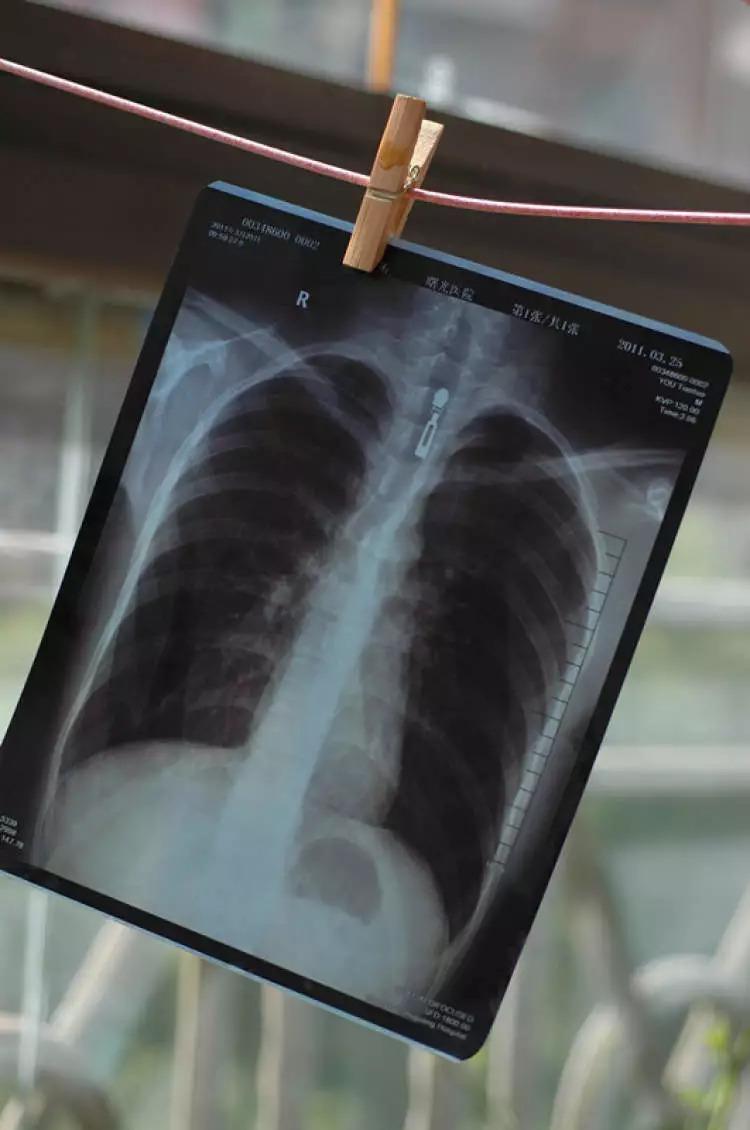 求职3个月做4次胸透!入职体检何时能共享,不用为份工作一遍遍抽血?