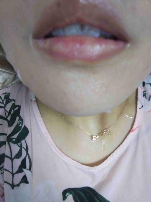 嘴唇上的白斑是什么?