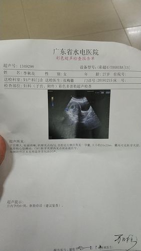 我想问一下,我前两天去做彩超,检查说孕囊在宫腔近左侧宫角,说正常是