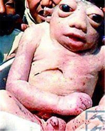 什么是青蛙人?尼泊尔青蛙人是真的吗?