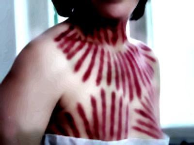 小孩中暑揪痧作文