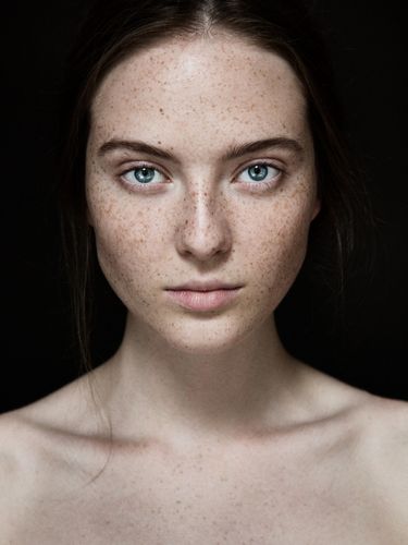 carsten witte:素颜雀斑女孩