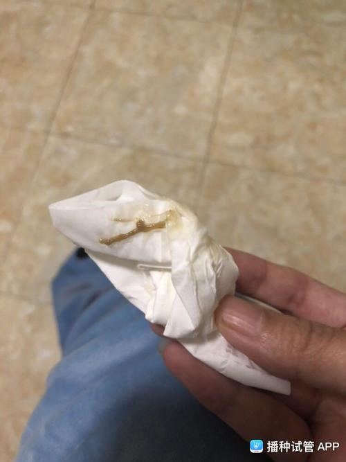 小姐妹们,今天移植52天,早上上完厕所有这样的分泌物,内裤也总是黄黄