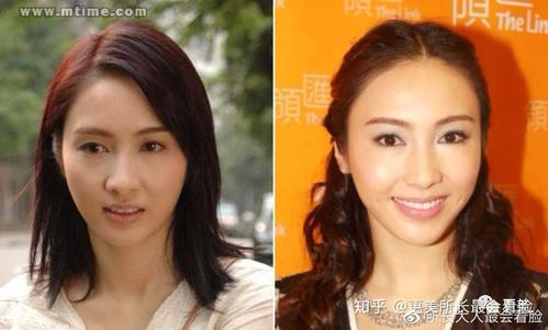 其实这个时期,黎姿的下巴就已经开始微调了.