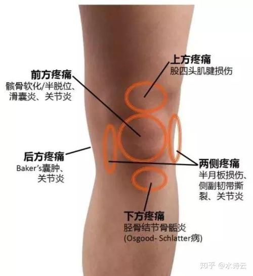 由于髌骨对人体的运动有非常重要的作用,一旦出现损伤,将严重影响个人