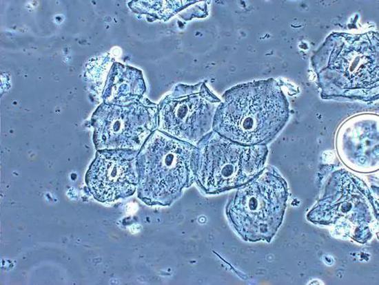 口腔各壁都有 a target="_blank" href="/item/黏膜/3111513" data