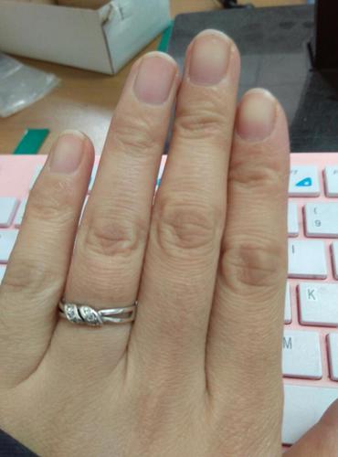 宝妈们看看我指甲颜色是紫的还是正常的