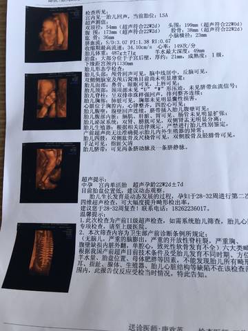 昨天刚做的四维彩超,这次做了说没问题,但医生说等28周了宝宝大点了再