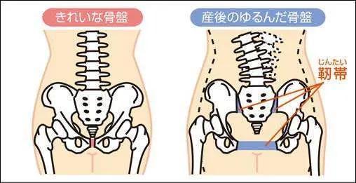 完善的骨盆修复主要是四骨复位:肋骨,髋骨,耻骨,大转骨.