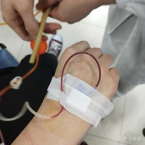 手上血管细输液扎针困难是一种什么体验?
