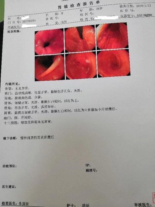 如何判定自己的胃病严不严重