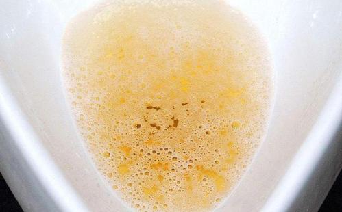 男人早上第一泡尿,如果长"这样",恭喜你,身体可能很健康!