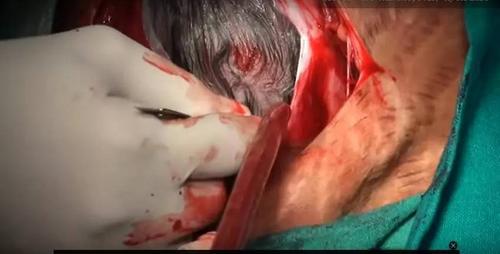 图解生孩子全过程,看完就知道妈妈的伟大!