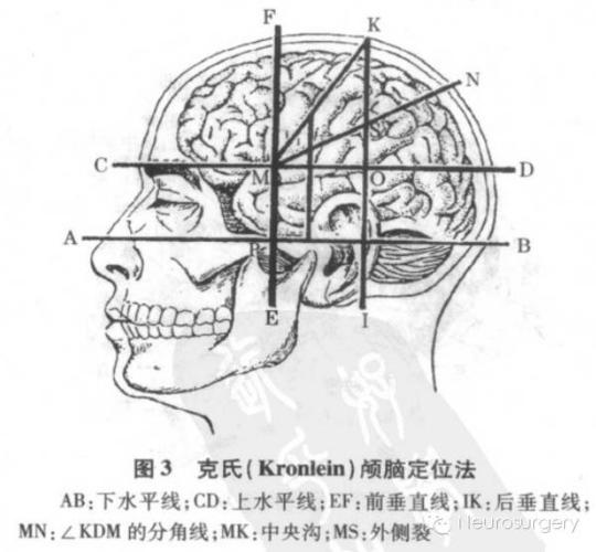 注意,这些数值对颅骨和颅内结构都非常重要!