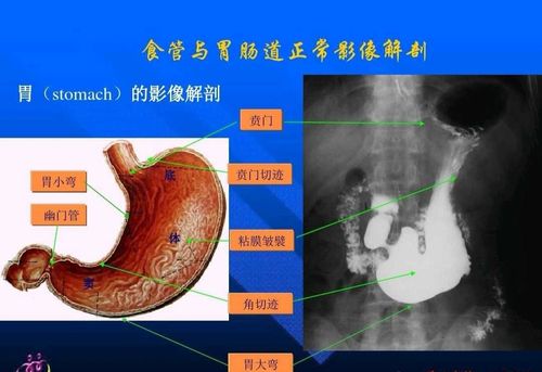 关于影像科的造影检查项目之上消化道造影