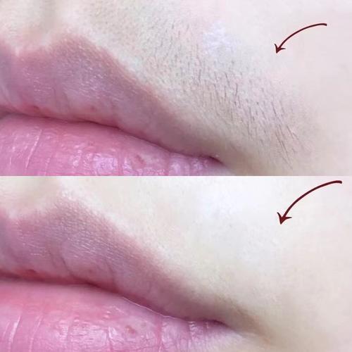 脱毛唇部蜡纸蜜蜡女士专用用去小胡子脱唇毛脸部脱毛膏