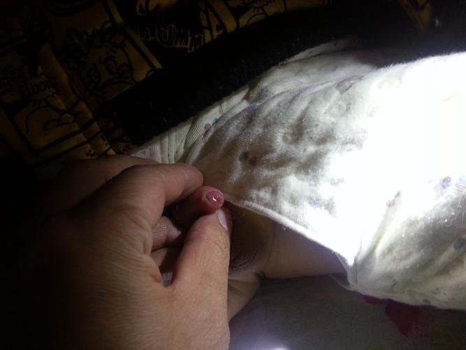 男宝宝 26月 看看正常吗