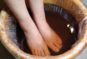 冬季食醋泡脚:促进血液循环 滋润全身肌肤