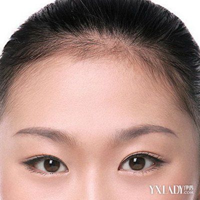 【图】韩式发际线的图片大全 发际线所造成问题以及解决方法
