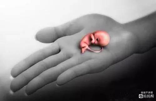 怀孕7周有胎心胎芽,第8周又没了,如何预防胎停育?