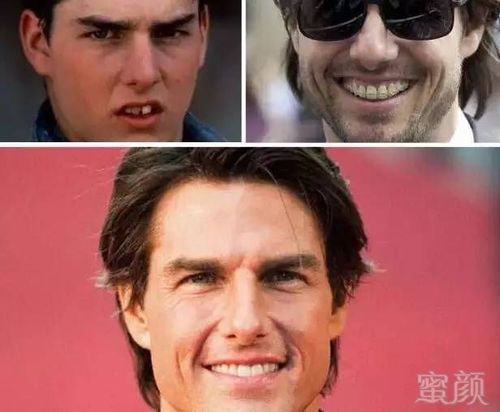 你所不知道的阿汤哥,胡歌,高圆圆等一众男神女神的整牙史!