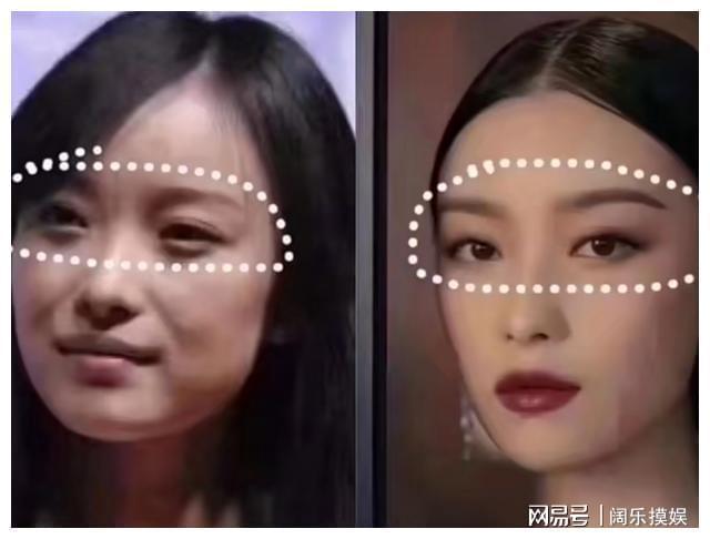 扑面而来的高级感眉骨填充指南虽迟但到