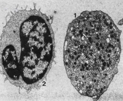 巨大血小板的透射电镜图象