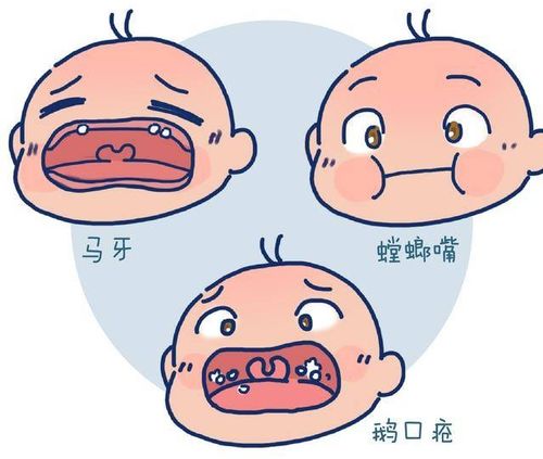 新生宝宝(0-1岁)需要护齿吗?这些口腔问题爸妈必须知道!