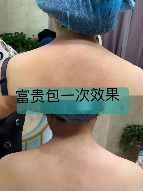 体态抗衰生殖骨雕介绍