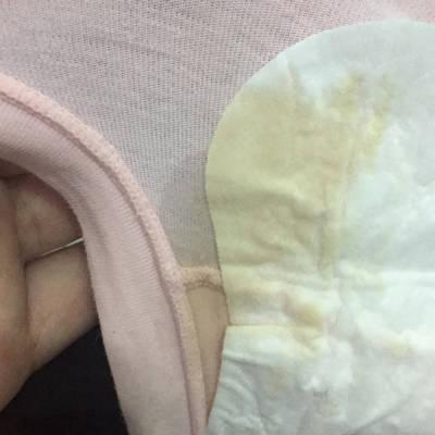 各位宝妈这个羊水吗 刚躺床上感觉像尿一样流出 像来姨妈 但肚子不疼