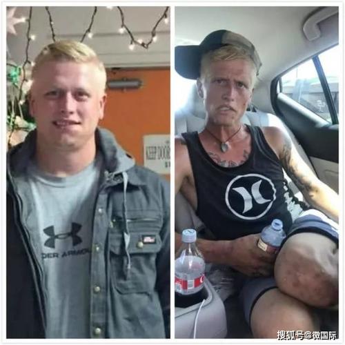 原创吸毒的危害有多大?吸毒前一表人才,吸毒后像骷髅,连亲妈都认不出