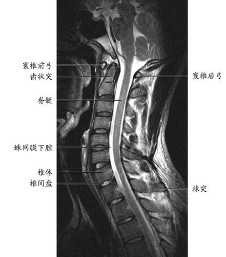 颈椎共有七块颈椎骨组成,除第一颈椎和第二颈椎外,其他颈椎之间都夹有