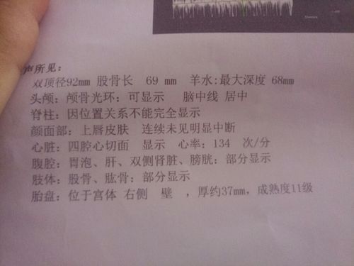 管管 我这38周羊水深度68mm会不会偏小 昨天38周 5