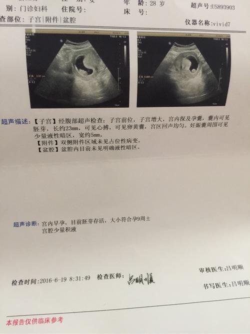 宝宝胎芽23mm.之前一超时妊娠囊是椭圆形的现在有点弯了……这里