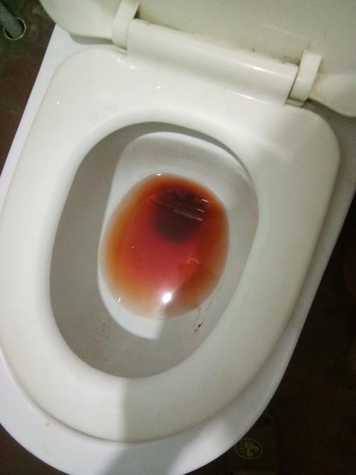 这几天,每天清早第一次小便尿血伴有血块