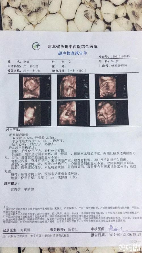 四维宝宝因为趴着所以只照了半边身子?