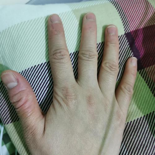 姐妹们,特别喜欢扣手指怎么办啊