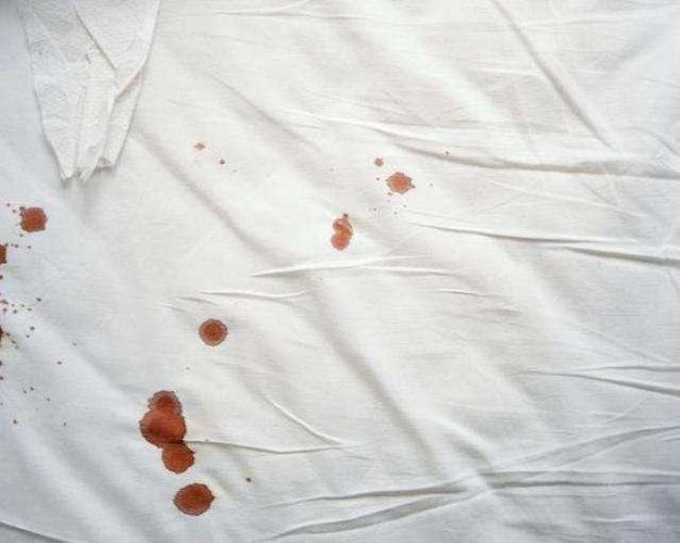 上厕所时若发现白带是这个颜色,可能是感染了hpv,不妨