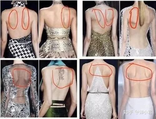 如果你的肩胛骨静止状态的时候,就不在正确的位置上,那么相应的