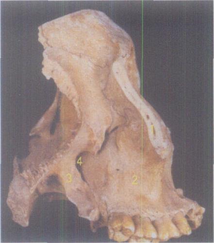 b 颅中窝 1 颧骨 zygomatic bone  2 上颌骨 maxilla  3 翼突外侧板