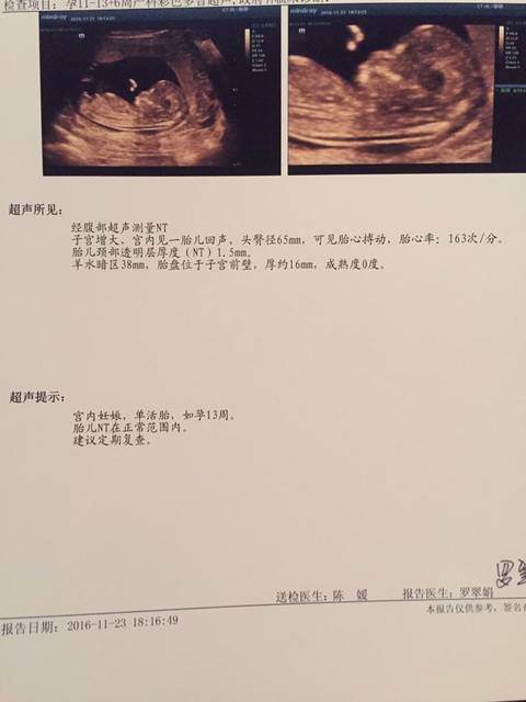 nt单可看男女准确率90nt可以看男女吗