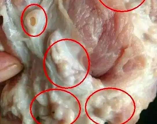  p>肉疙瘩又名瘢痕,是因伤造成局部组织增生形成 a href="#" data