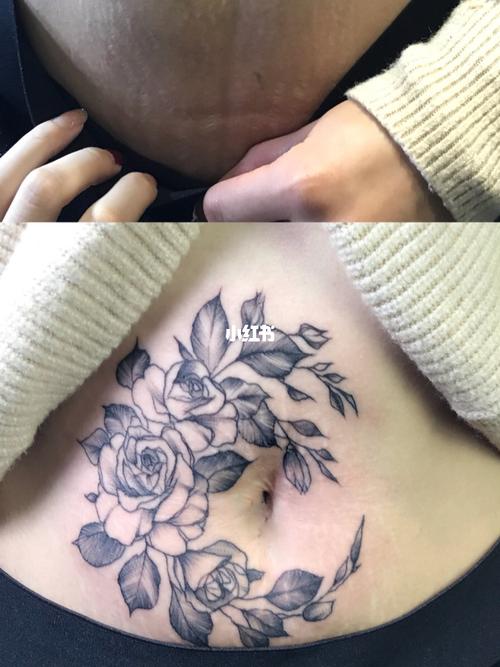 妊娠纹遮盖#剖腹产遮盖#遮盖纹身