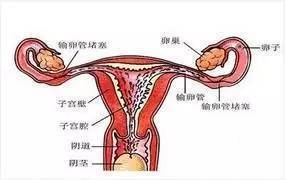 输卵管堵塞造影和通液怎么选