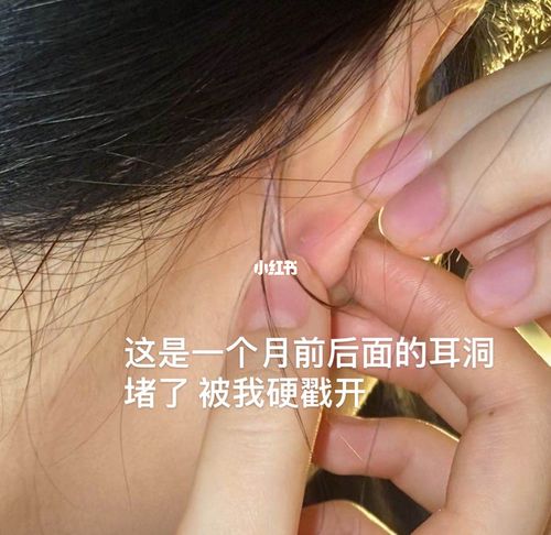 耳钉_耳洞_发炎_清洁_时尚