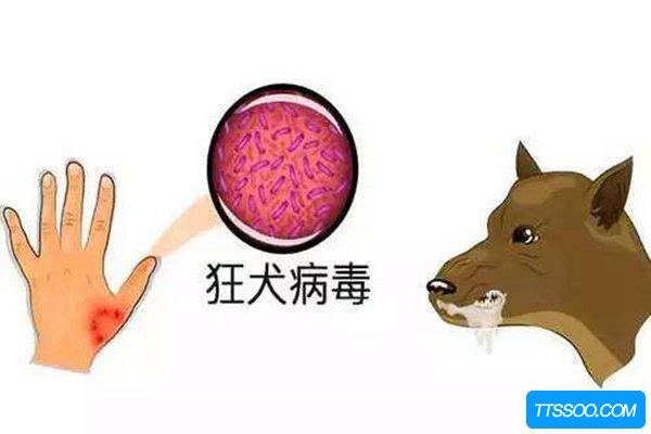 狂犬病的早期症状