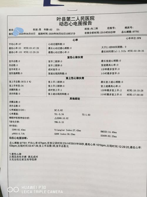 我院动态心电图报告