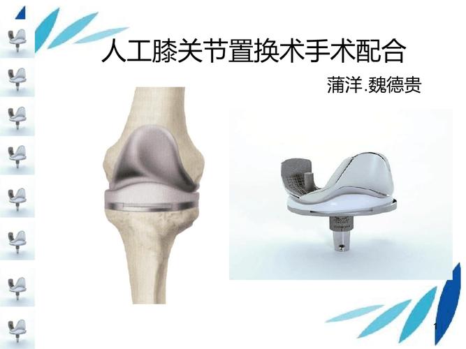 全膝关节置换术参考幻灯片.ppt 19页