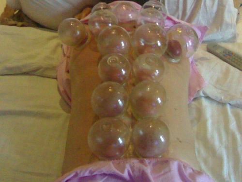 1元抢购肩颈刮痧拔罐艾灸