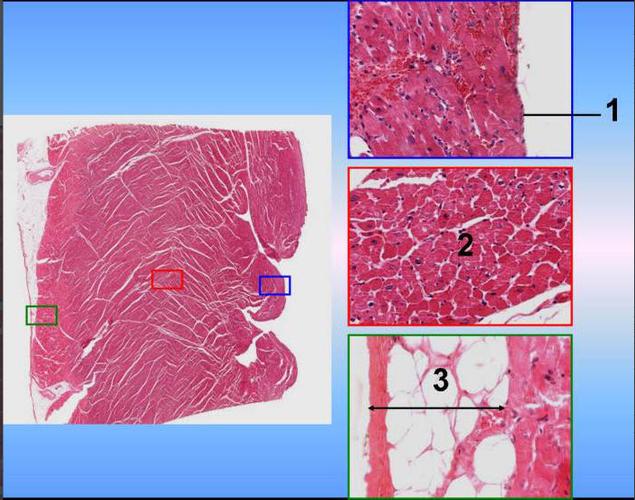 心室壁光镜像,请判断图中3所示的是何种心壁结构?()